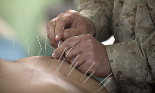 acupunctuur-US-Navy
